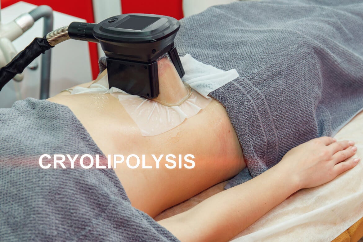 CoolSculpting and Paradoxical Adipose Hyperplasia